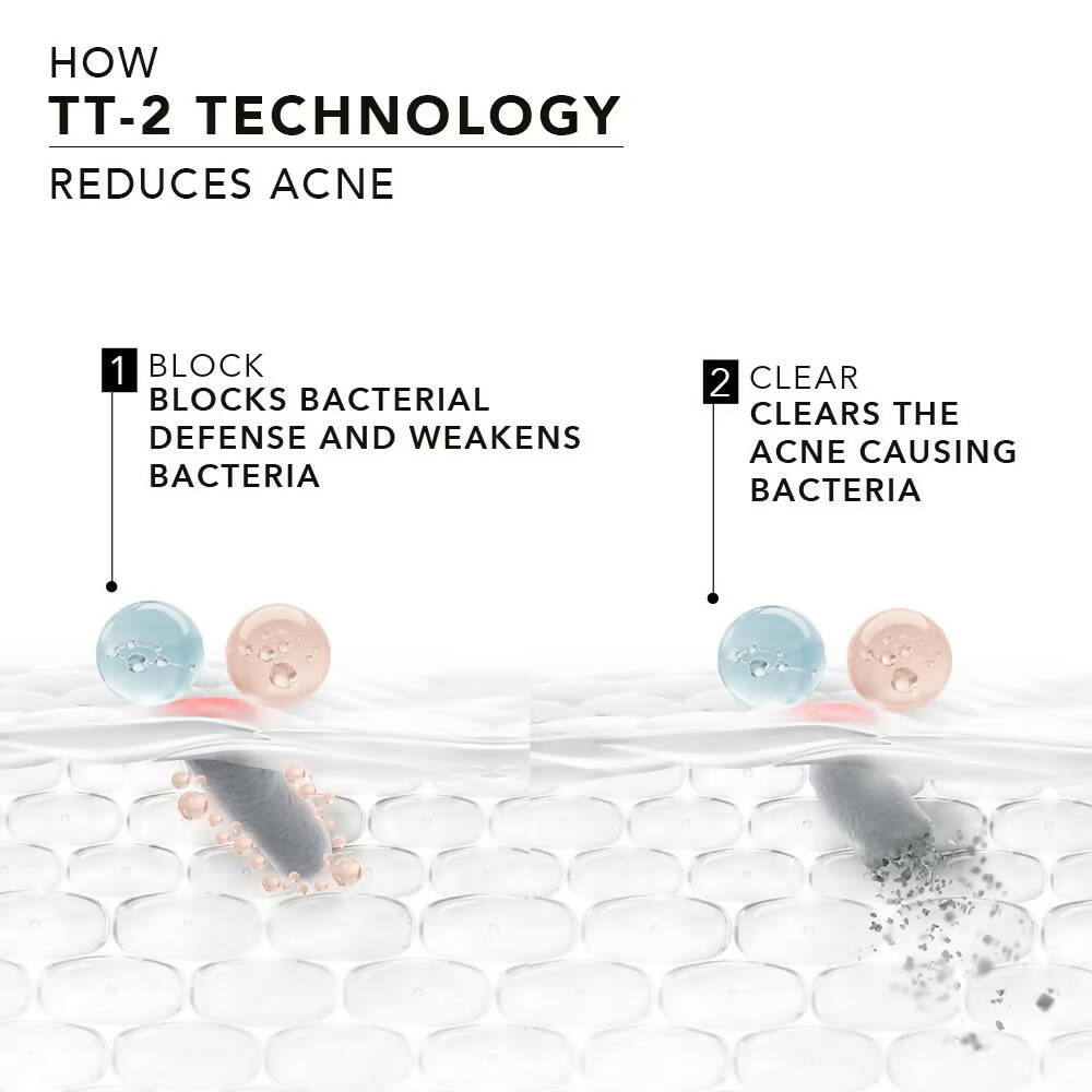 Novology Acne Reduction Serum With 0.1% Thymol + Terpineol