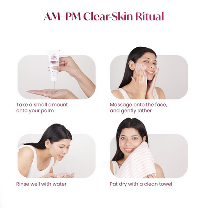 Alite Anti-Acne 5-in-1 Face Wash - Encapsulated Charcoal, Sebum Control Enzyme & Ceramides