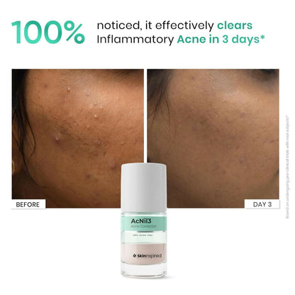 SkinInspired AcNil3 Rapid Spot Corrector
