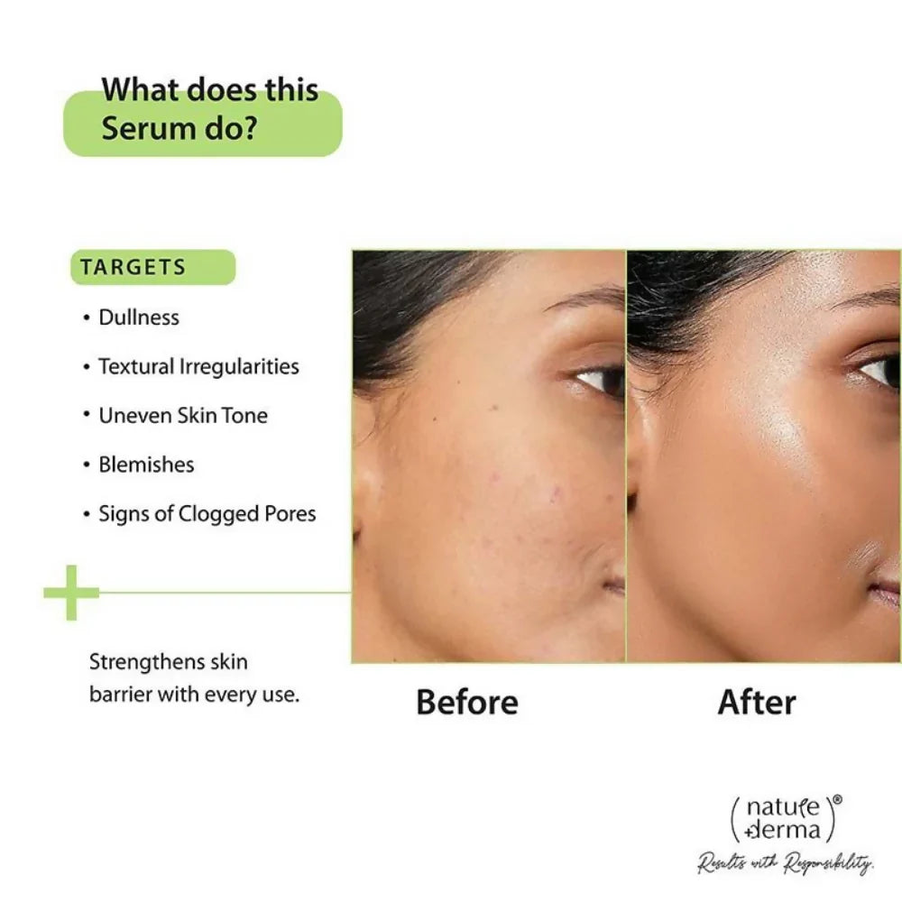 Nature Derma 10% Niacinamide & Zinc Serum -10 ml