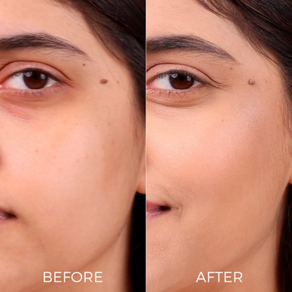 Brillare AHA BHA Exfoliating Face Peeling Solution