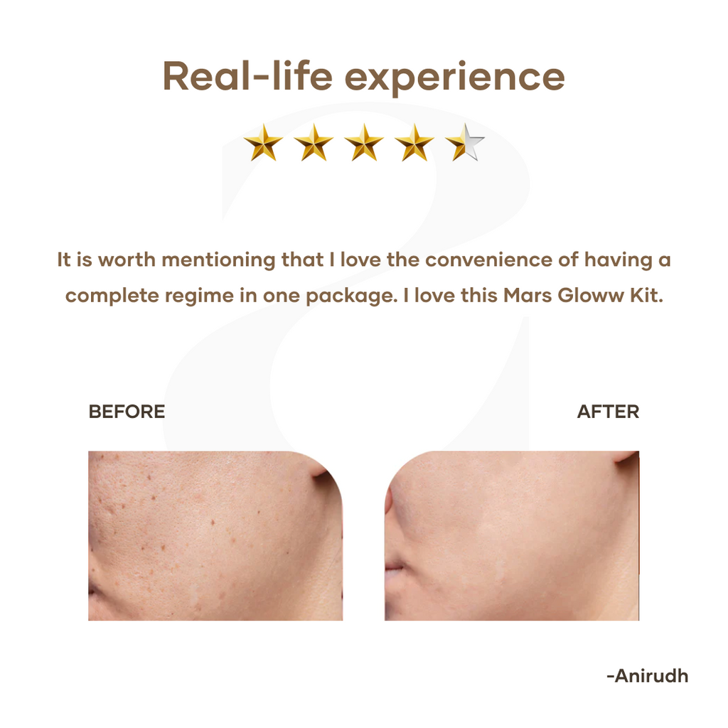 Mars by GHC Gloww Kit for Radiant Skincare Routine