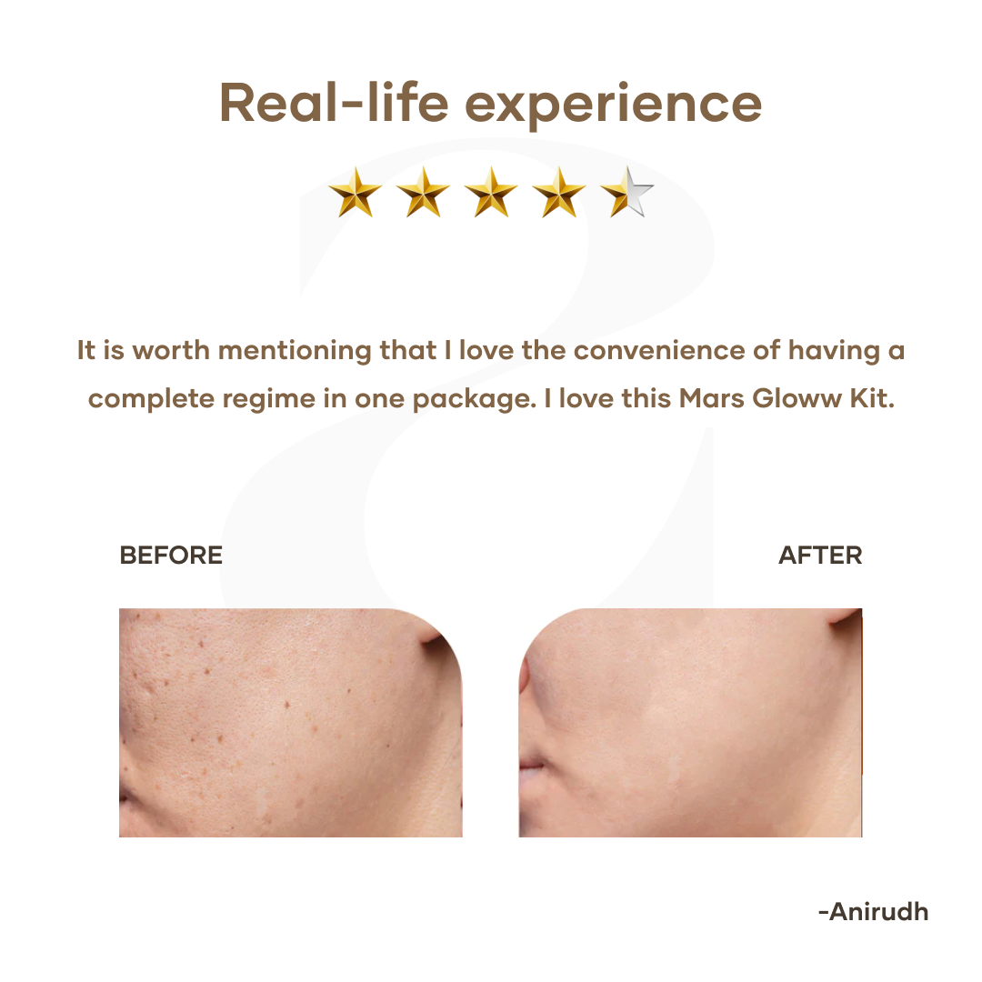 Mars by GHC Gloww Kit for Radiant Skincare Routine