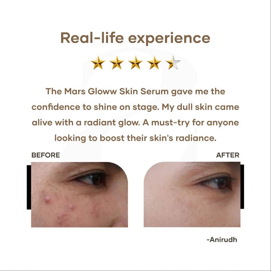Mars by GHC Gloww Skin Serum with Vitamin C - 30 ml