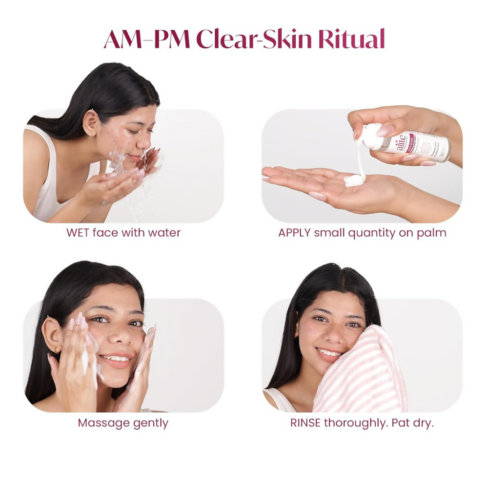 Alite Anti Acne 5-in-1 Foaming Face Wash with 4% Glycolic Acid & 1% Salicylic Acid