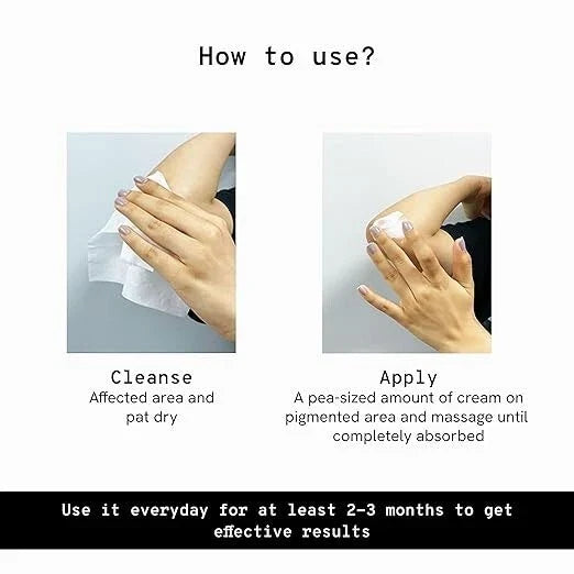 Be Bodywise Pigmentation Cream 100gm | 2.5% Lactic Acid, 2% Urea, Retinol