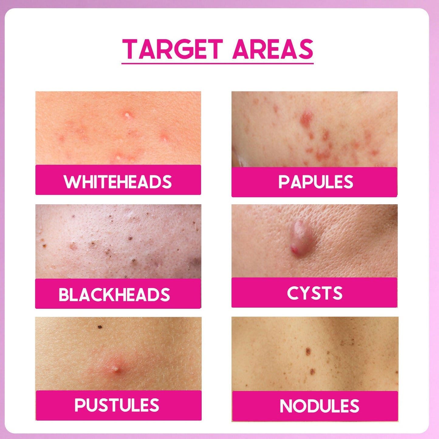 Cos-IQ ABP 22% Regular Use Exfoliating Peel