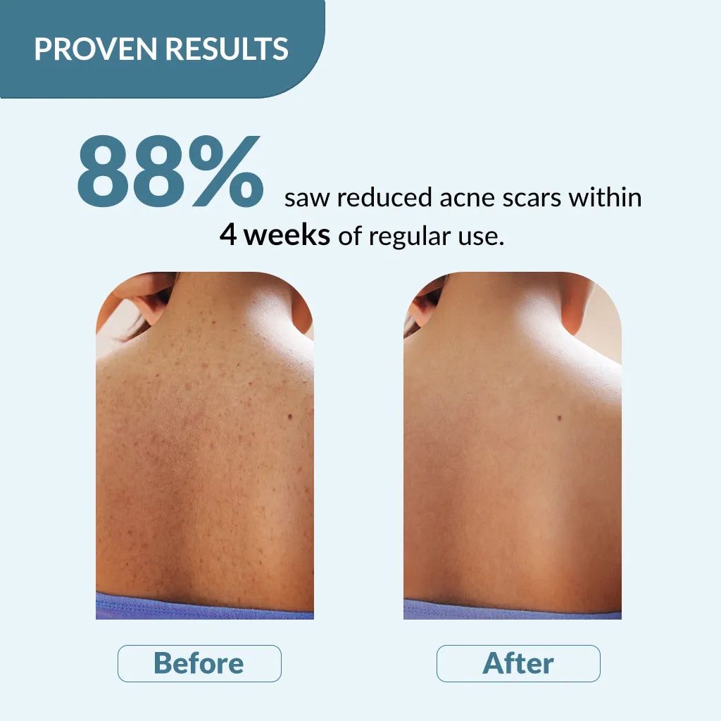 Fixderma Salyzap Body Wash