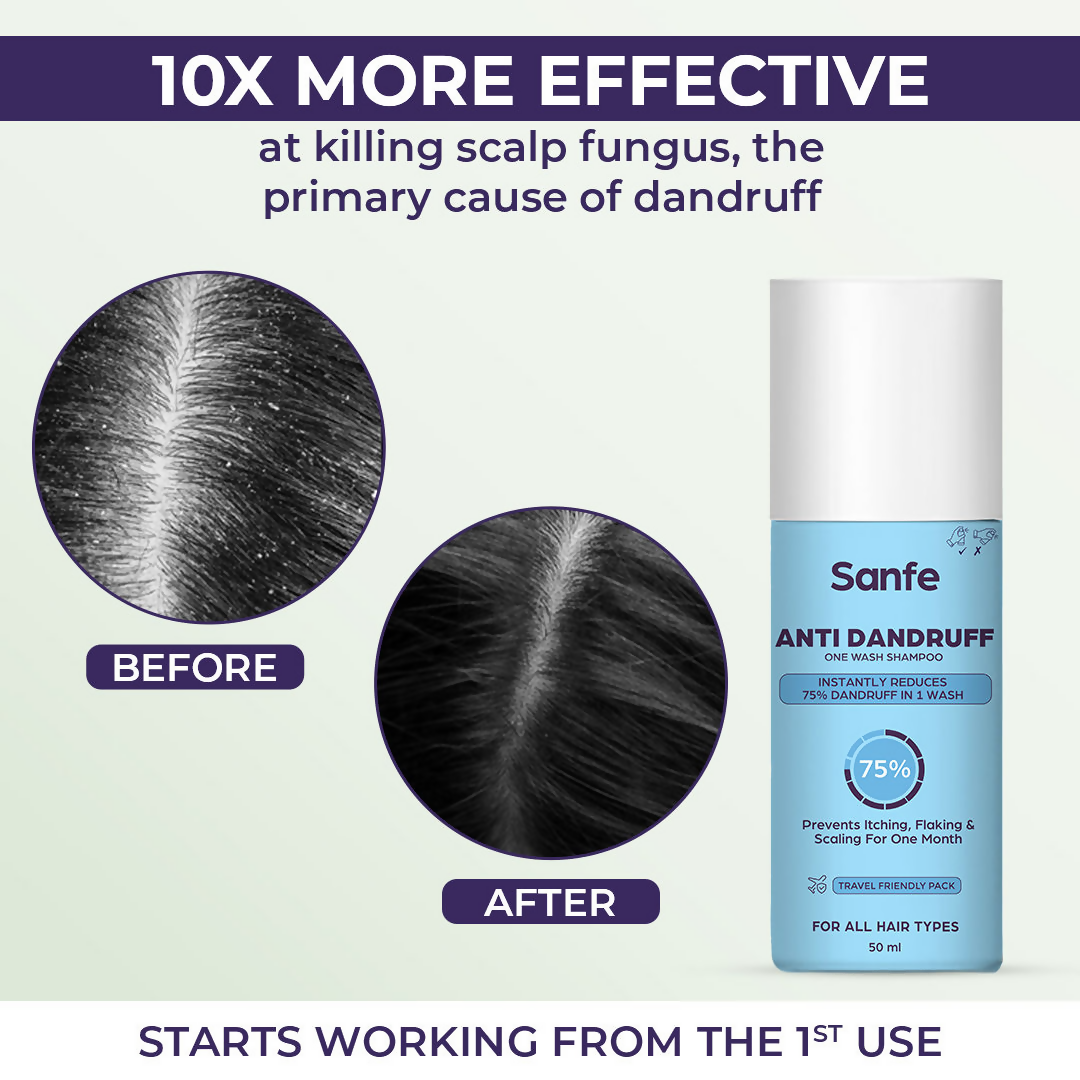 Sanfe Anti Dandruff One Wash Shampoo