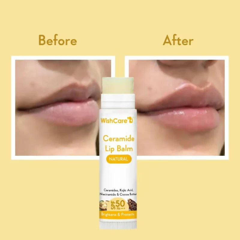Wishcare Ceramide Lip Balm - SPF 50 | (5g)