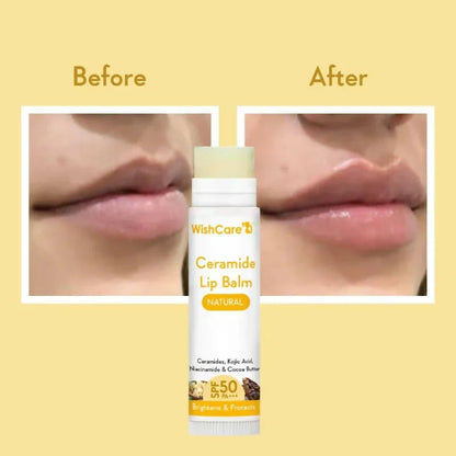Wishcare Ceramide Lip Balm - SPF 50 | (5g)