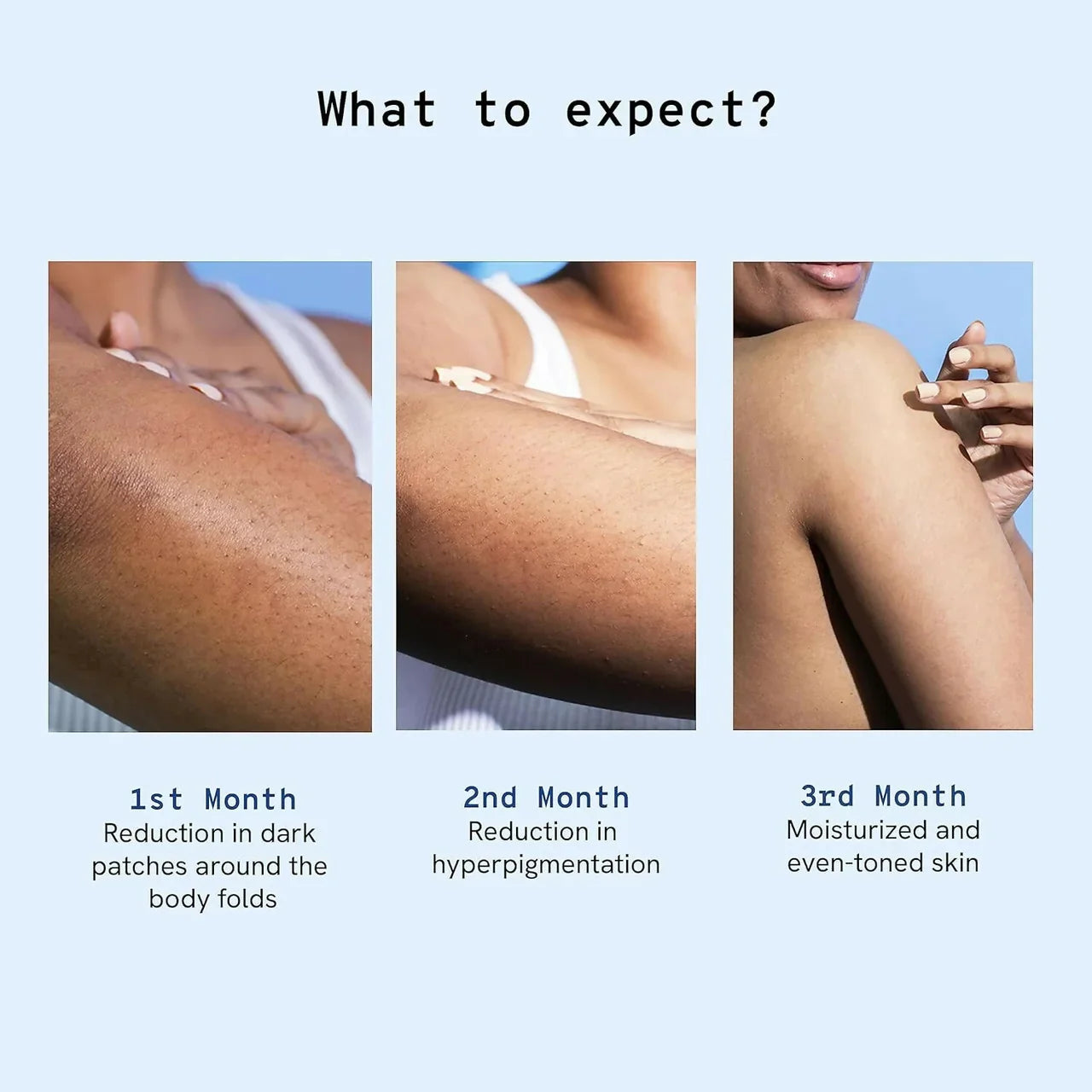 BeBodywise Pigmentation Repair Cream -100 gm