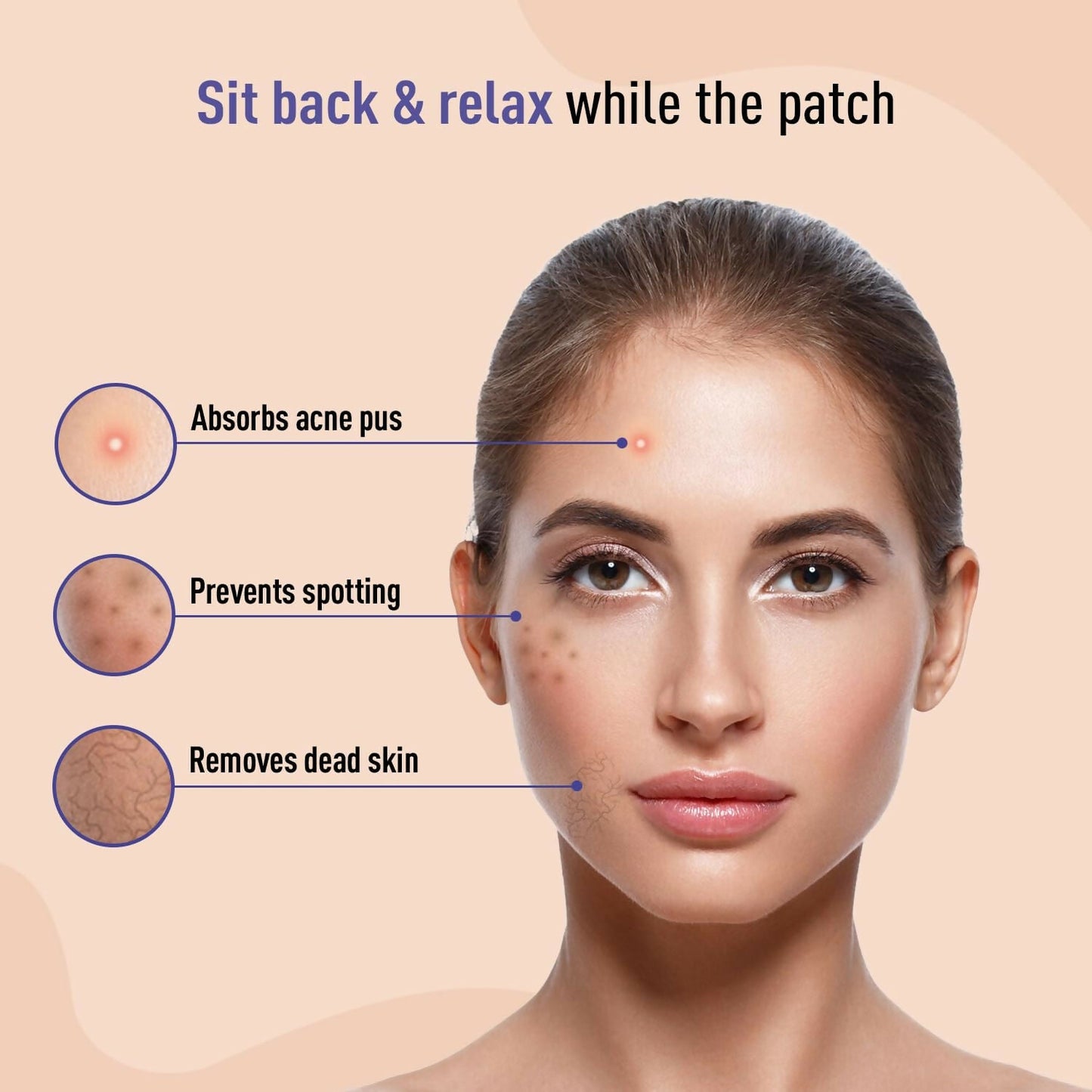 Sirona Anti Acne Pimple Patches For Face with 0.5% Salicylic Acid Invisible Facial Stickers Cover